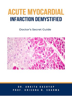 cover image of Acute Myocardial Infarction Demystified